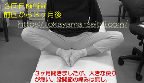 3回目施術前スナップショット(前回から3か月後):右股関節の痛み無し、股関節の可動域は大きな戻り無し