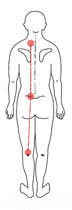 左膝裏が痛くてしゃがめない40代女性の痛みの分布図