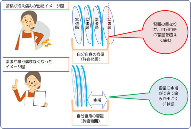 緊張の蓄積が許容範囲を超えると痛み、余裕ができると痛みが出にくくなる図