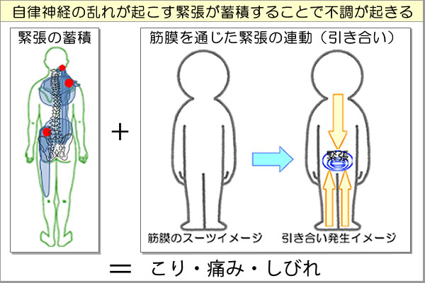 緊張の蓄積と筋膜を通じた引き合い現象(連動現象)が筋肉の緊張(こり・痛み・しびれ)を生む