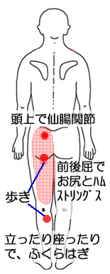 坐骨神経痛30代男性