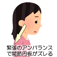 からだの緊張のアンバランスが関節円板のズレに影響する(引き合い現象)図