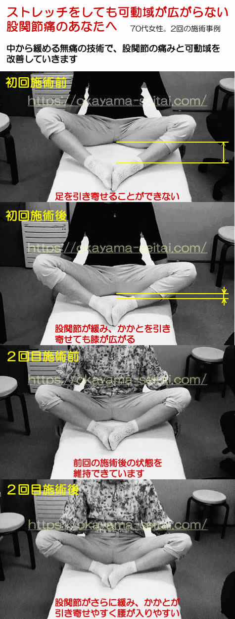 緊張の蓄積を減らす技術で、股関節の痛みと可動域が改善した事例