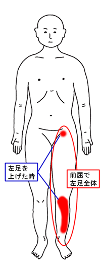 動きの確認：膝、脛、股関節の痛点の位置